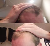 hair