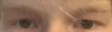 eyes