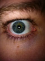 Eye