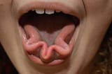 tongue thing