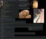 the horrors of gay sex and anal sex