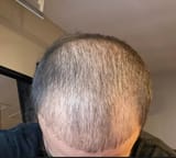 Thread 82178646 OP Image