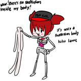 skeleotne