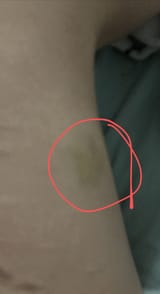 markup_1000018828