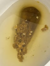 flaky-fluffy-stool-pics-attached-v0-zxqqxx7k8uze1