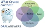 cause_of_cavities_tooth_decay-1989548868