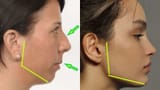 recessed-vs-forward-faces-2010183082
