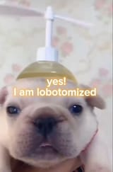 lobotomy
