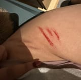 Thread 34138601 OP Image