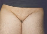 bush