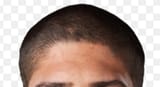 hairline