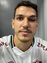 nino-postou-foto-de-galo-na-cabeca-apos-choque-na-vitoria-do-fluminense-sobre-o-athletico-1634507210140_v2_450x600
