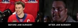 Bedard Before After
