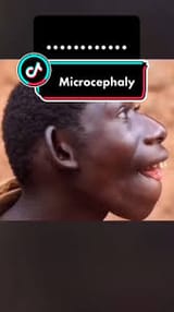 Itissofuckingoverforbuckcels