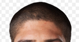 hairline