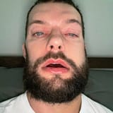 balorkek