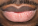 SGA lips