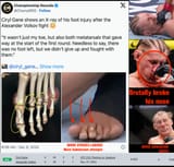 won_with_broken_foot