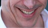 totosmile