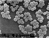 Staphylococcus_aureus_01