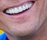 Cristiano-Ronaldo-Teeth-Transformation~3