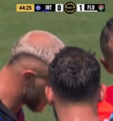Bald Dimarco (37)