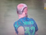 Bald Dimarco (43)