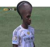 178548387709715