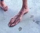 flipper