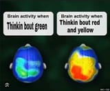 Brain activity