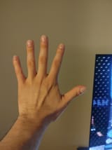 1000002125