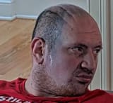 based bald retard