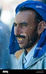 a-man-with-bad-teeth-D5E0GD