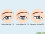 v4-460px-Negative-Canthal-Tilt-Step-1