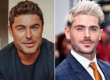 Zac-Efron-Plastic-Surgery-Accident-3674189478