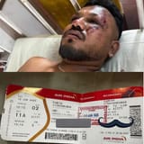 a-single-guy-survived-the-deadly-plane-crash-in-india-that-v0-am3zowd5ei6f1