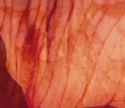 1740074450601732_thumb.jpg