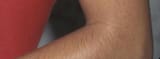 HairyArm