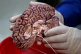 Scientists Hunt Down Genes Behind Humankind&#039;s Big Brain – The Wi