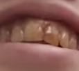 eww
