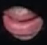 megalips