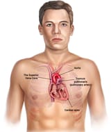 4_Heart_engelsk