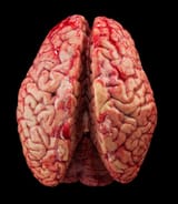 unfixed-brain