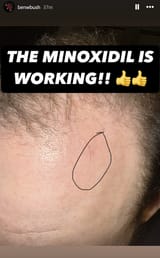 Benitsworking