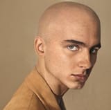 bald0-timmy