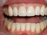 teeth