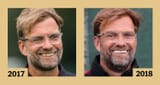 kloppsbeforeandafter