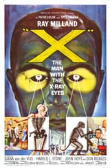 X-RayEyes_Rep[1]