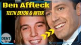 maxresdefault