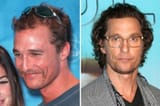 Matthew-McConaugheys-Hair-Transplant-Why-The-Rumour-Started